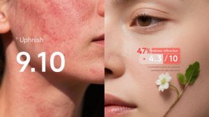 The #1 Ingredient for Soothing Sunburned Skin? Centella Asiatica Extract